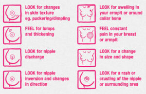 Breast cancer treatment in India