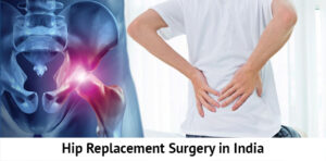 Total Hip Replacement