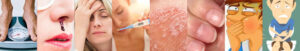 Signs and symptoms of Leukemia