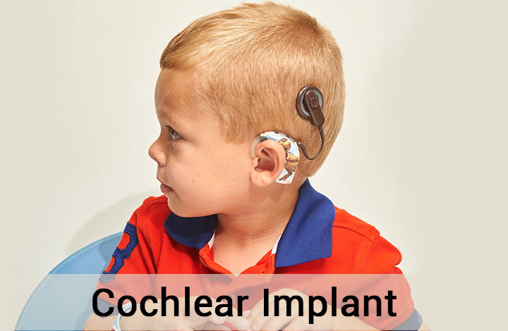 Cochlear implant in India