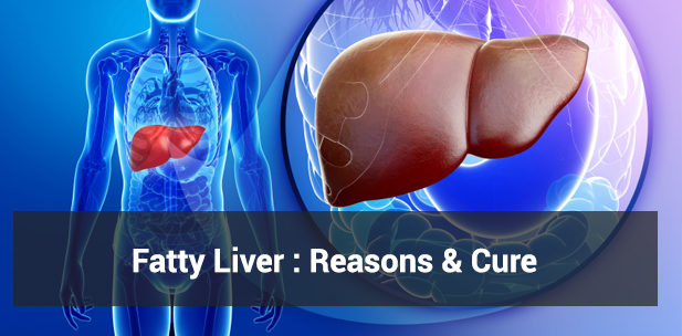 fatty liver reasons and cure