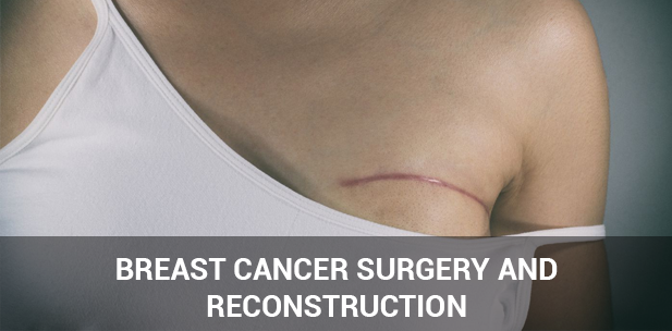 Breast cancer surgery