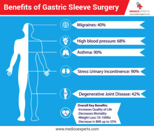 Gastric Sleeve Surgery Benefits
