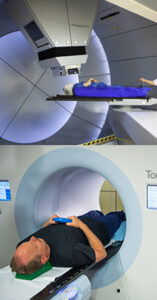 Stereotactic Radiosurgery