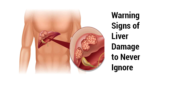 Liver damage and liver transplant in India