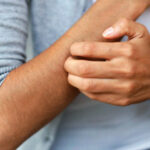 warning signs of liver damage, Liver disease warning signs - Itching