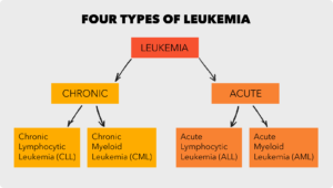 Types of leukemia