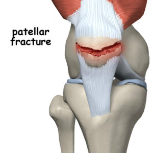 treatment for knee injury