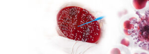 blood-cancer-treatment