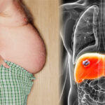 liver damage warning signs - Swelling in the abdomen