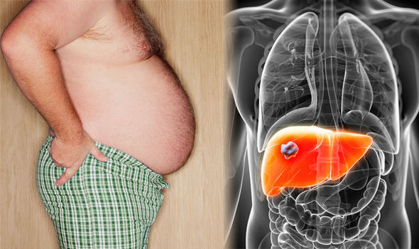 liver damage warning signs - Swelling in the abdomen