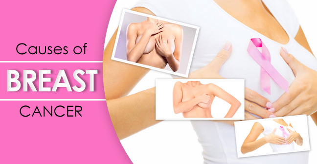 KNOW THE VARIOUS CAUSES AND RISK FACTORS ASSOCIATED WITH BREAST CANCER IN FEMALES 8 Causes of Breast cancer