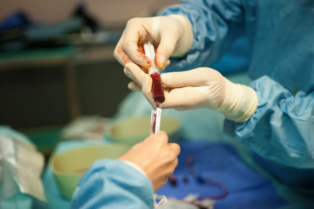 7 FACTS AND MYTHS ABOUT BONE MARROW TRANSPLANT MedicoExperts