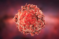 cancer treatment in India | MedicoExperts