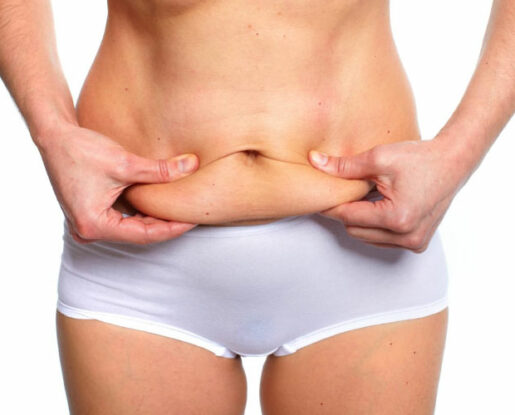 LiposuctionTummyTuckWhatAmIACandidateFor LiposuctionTummyTuckWhatAmIACandidateFor
