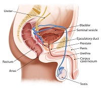 cancer treatment in India | MedicoExperts