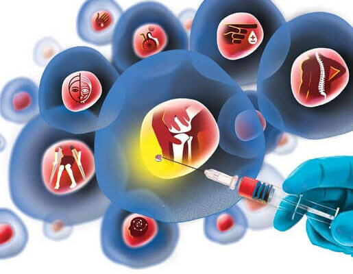 Stem-cell-therapy-in-India Stem-cell-therapy-in-India, stem cell treatment in india, stem cell treatment
