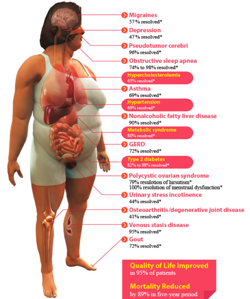 bariatric-benefits-surgery-wl bariatric-benefits-surgery