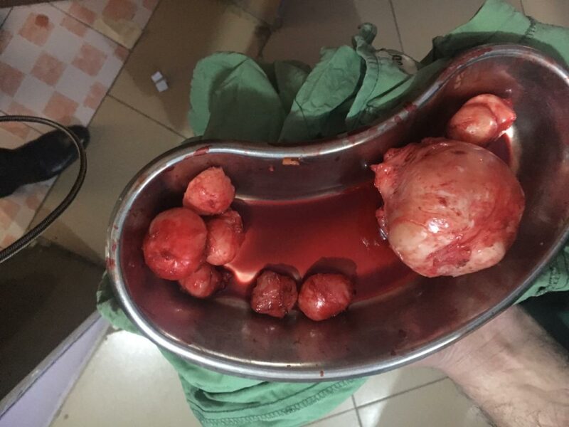 Port Harcourt OPD & Surgical Camp March 2018 | MedicoExperts