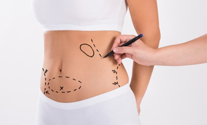 Cosmetic Surgery in Nigeria | MedicoExperts