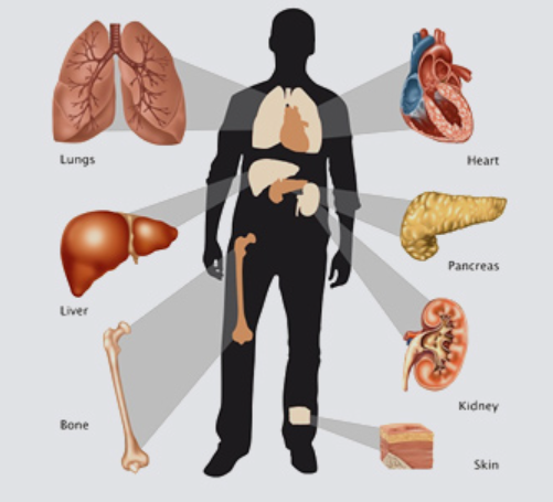 Organ Transplantation in India