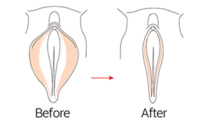 Cosmetic Surgery in Nigeria | MedicoExperts