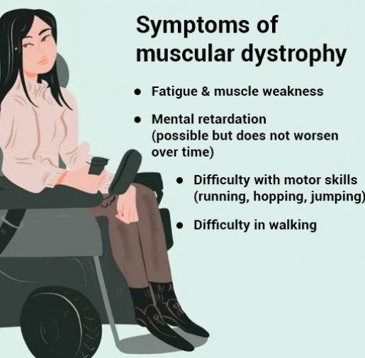 Symptoms-of-muscular-dystrophy, best treatment for muscular dystrophy