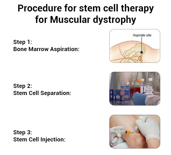 Procedure for stem cell therapy for Muscular dystrophy, possible cure for muscular dystrophy, muscular dystrophy treatment in india