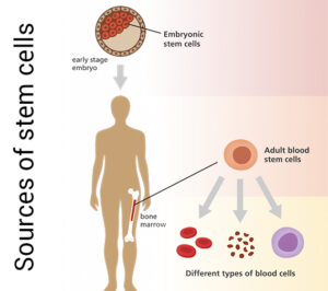 sources-of-stem-cells, embryonic cells, embryonic stem cell, adult stem cell, stem cell therapy cost