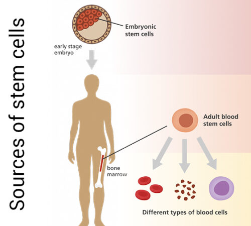 sources-of-stem-cells, embryonic cells, embryonic stem cell, adult stem cell, stem cell therapy cost