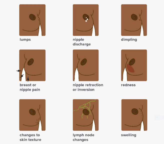 Blood Cancer Symptoms Pictures Blood Cancer Symptoms, Breast Cancer treatment cost in India, breast cancer treatment in india