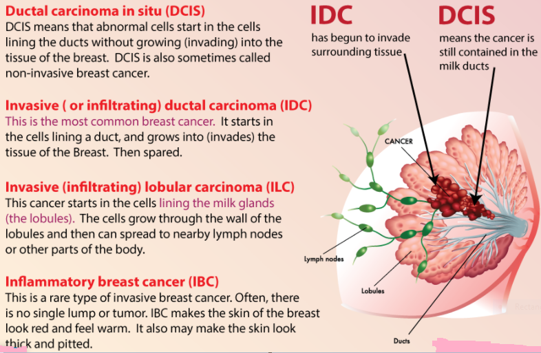 Breast Cancer Types, breast cancer treatment in india, best breast cancer hospital in india