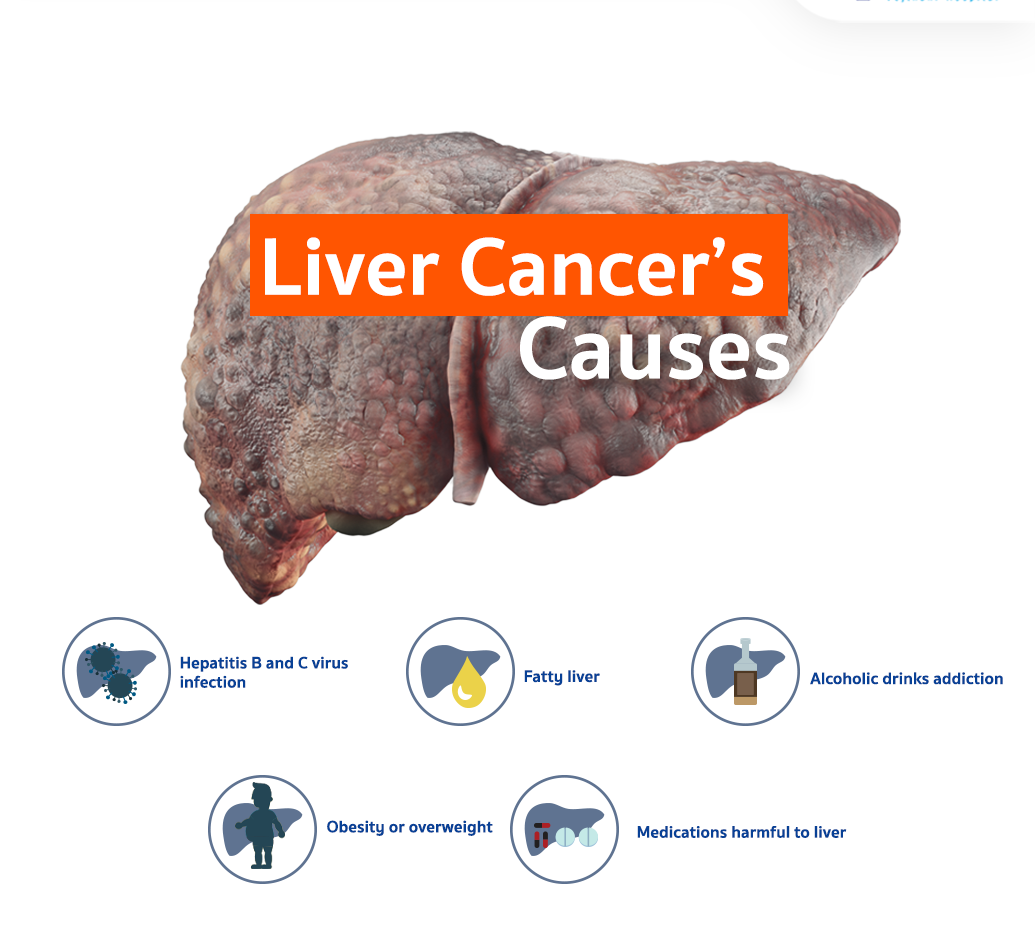 causes of liver cancer, liver cancer treatment cost in india