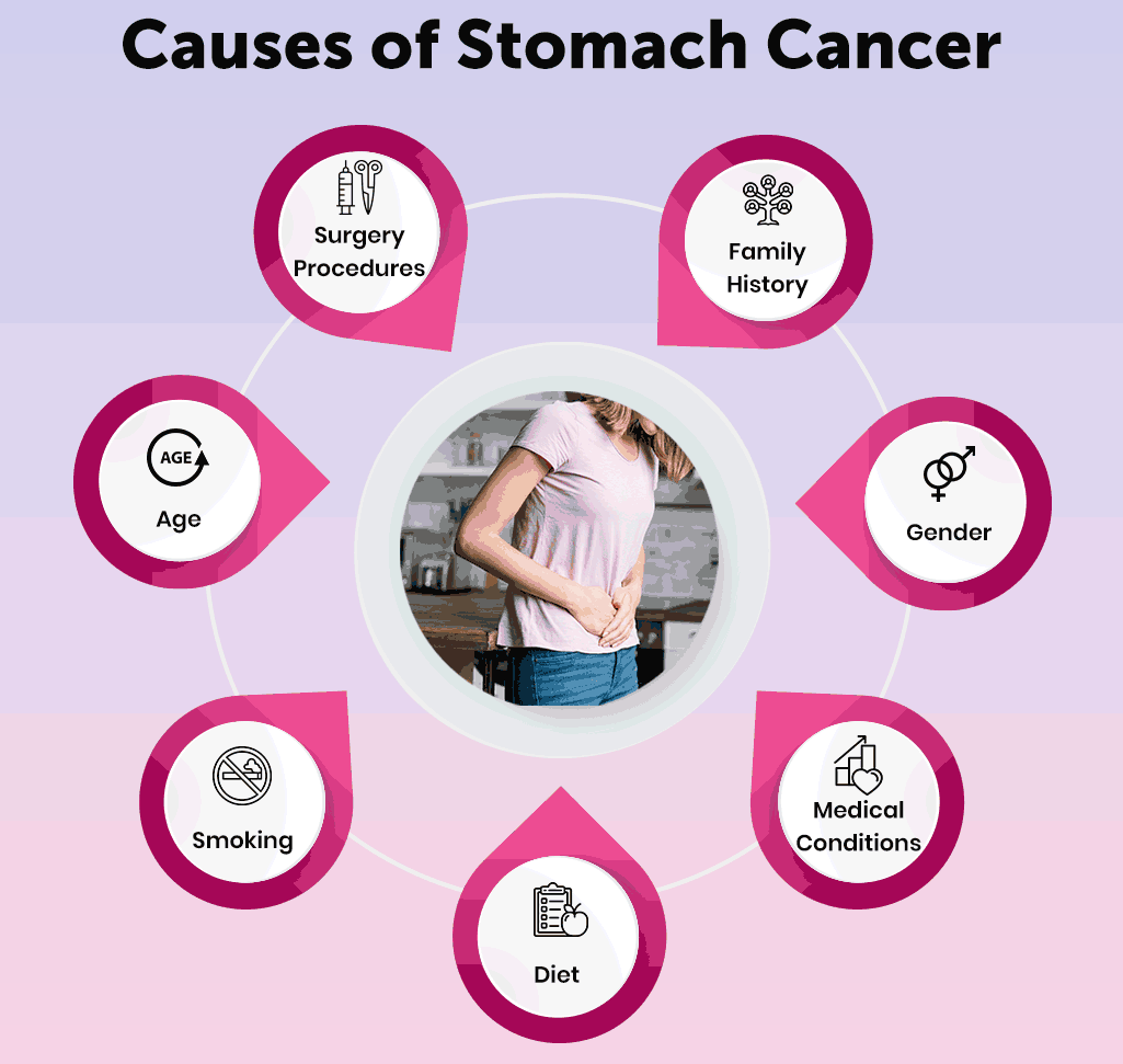 Various risk factors of stomach cancer, best stomach cancer doctor in india, stomach cancer treatment in india