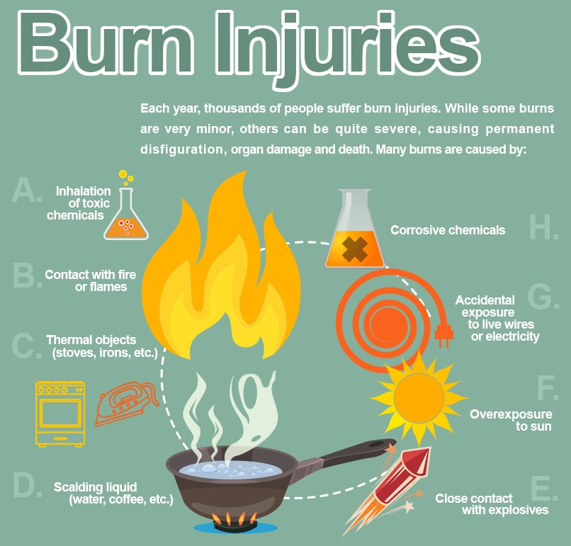 burn-injury-causes