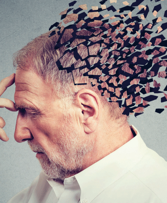 Stem cell therapy for dementia in India Stem cell therapy for dementia in India, dementia treatment in india