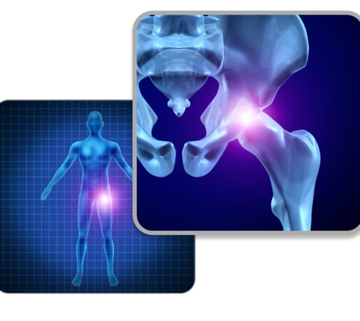 hip pain symptoms, stem cell treatment for hip joint, hip pain treatment without surgery