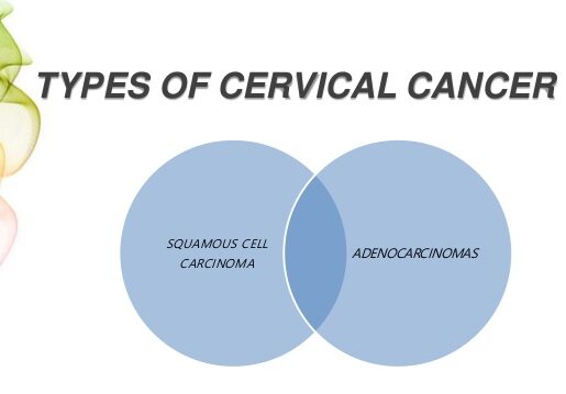 images of cervical cancer types images of cervical cancer types