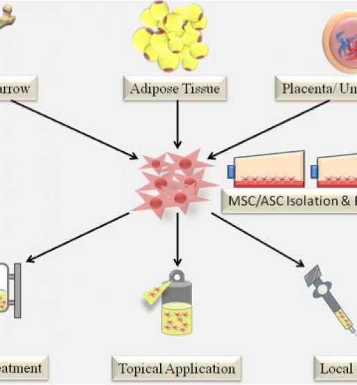 stemcell for burn injuries