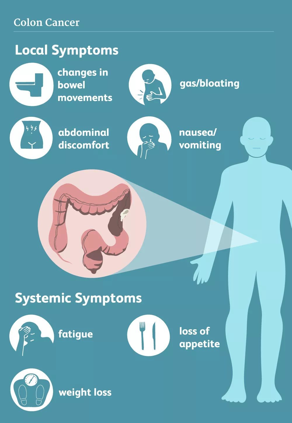 what is the symptoms of colon cancer, best colon cancer hospital in india, best colon cancer treatment doctors in india