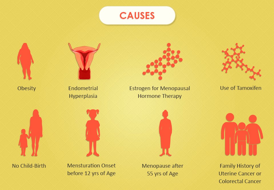 Causes of uterine cancer Causes of uterine cancer