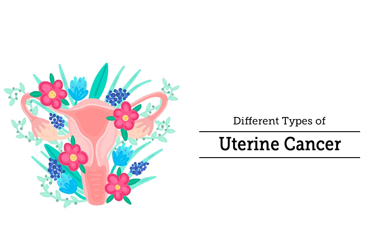 Types of Uterine Cancer, cost of uterine cancer treatment in india
