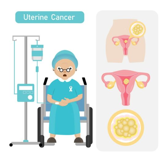 uterine cancer treatment in india, treatment of uterus cancer in india