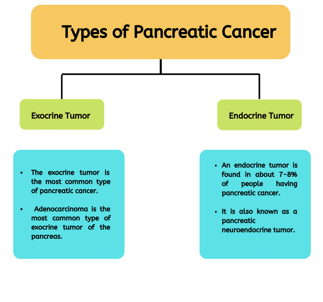 types of pancreas cancer