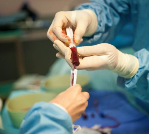 Bone marrow transplantation in India, BMT in india