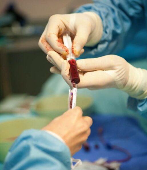 bone-marrow-transplant