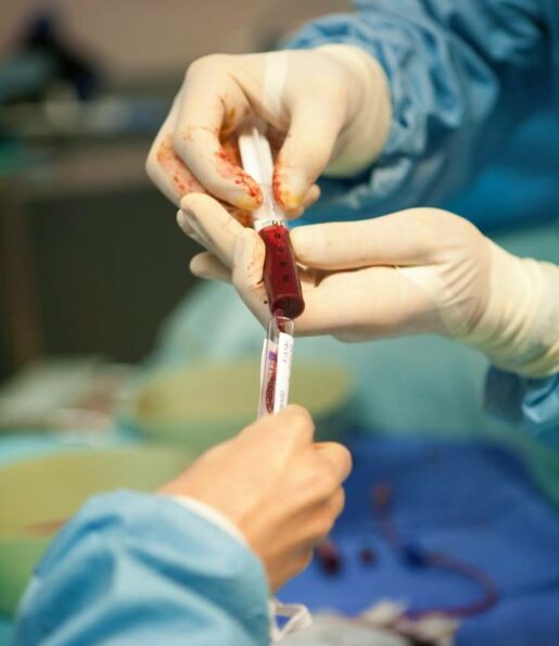 Bone marrow transplantation in India Bone marrow transplantation in India, BMT in india