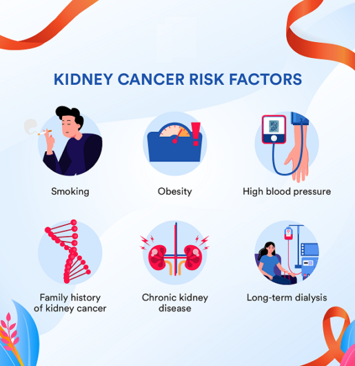 kidney cancer risk factors