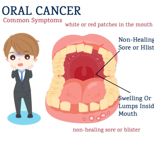 oral cancer symptoms, Oral cancer treatment, mouth cancer treatment in india