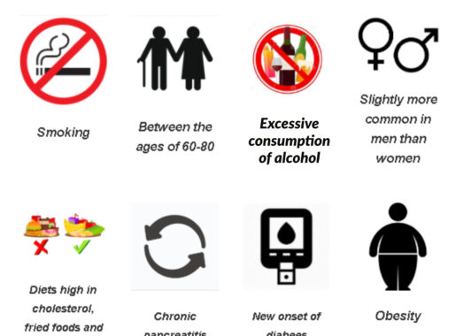risk factors of pancreas cancer Risk factors associated with pancreatic cancer
